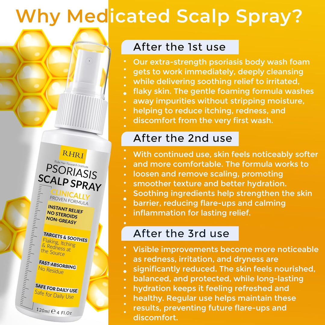Psoriasis Scalp Spray | Tratamiento de psoriasis y caspa para infec...