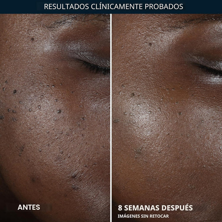 RoC Multi Correxion 5 en 1 Crema Nocturna Restauradora, Antienvejec...