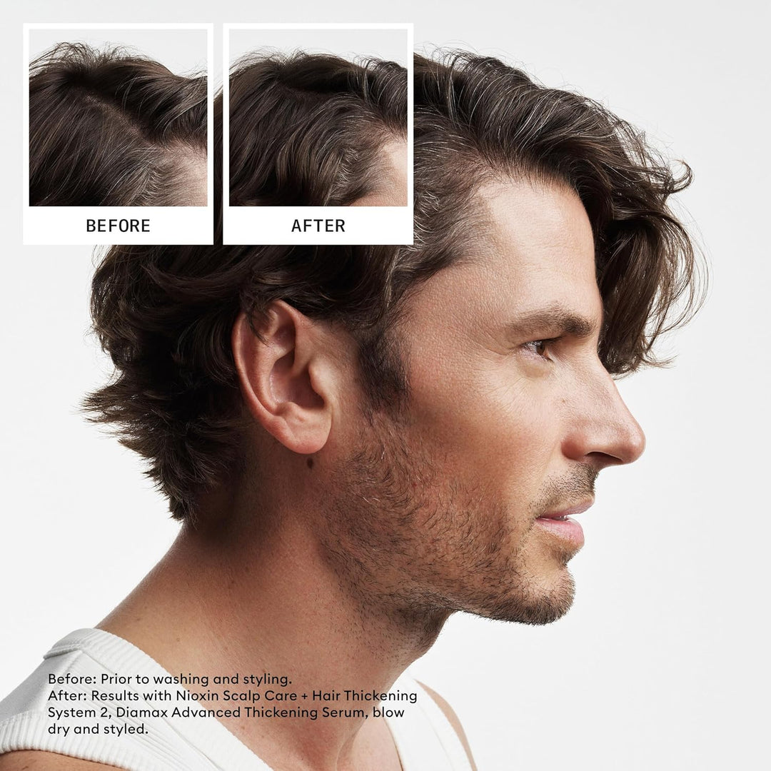 Nioxin System 2 Scalp Care + Hair Thickening Leave-In Treatment | F...