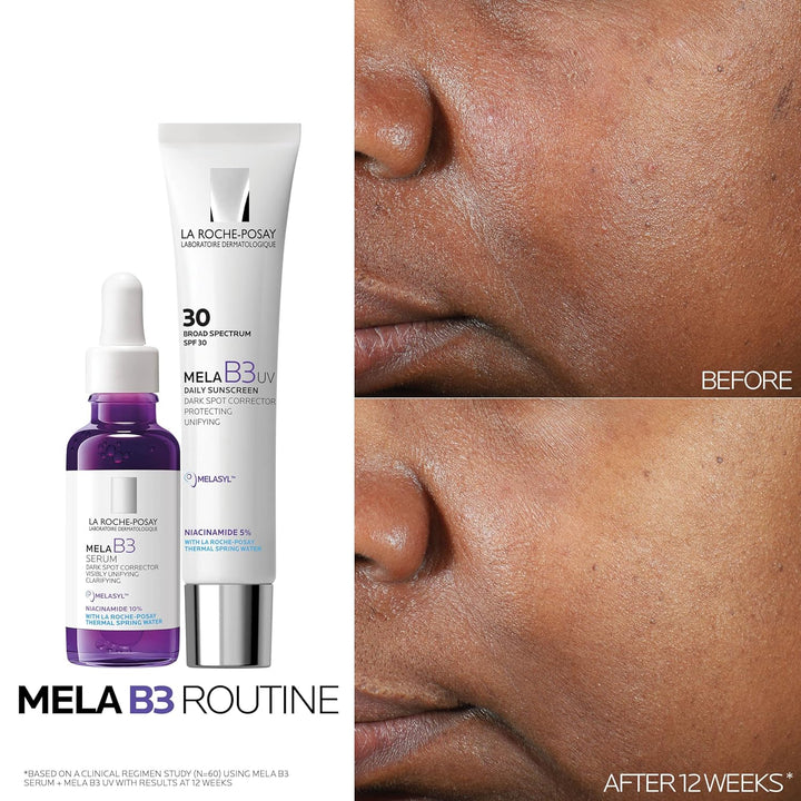 La Roche-Posay Mela B3 Serum, Dark Spot Corrector With Anti-Aging M...