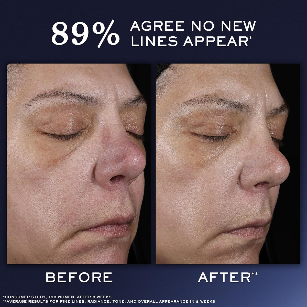 Lancôme Génifique Ultimate Dual Recovery Face Serum - Suero antienv...