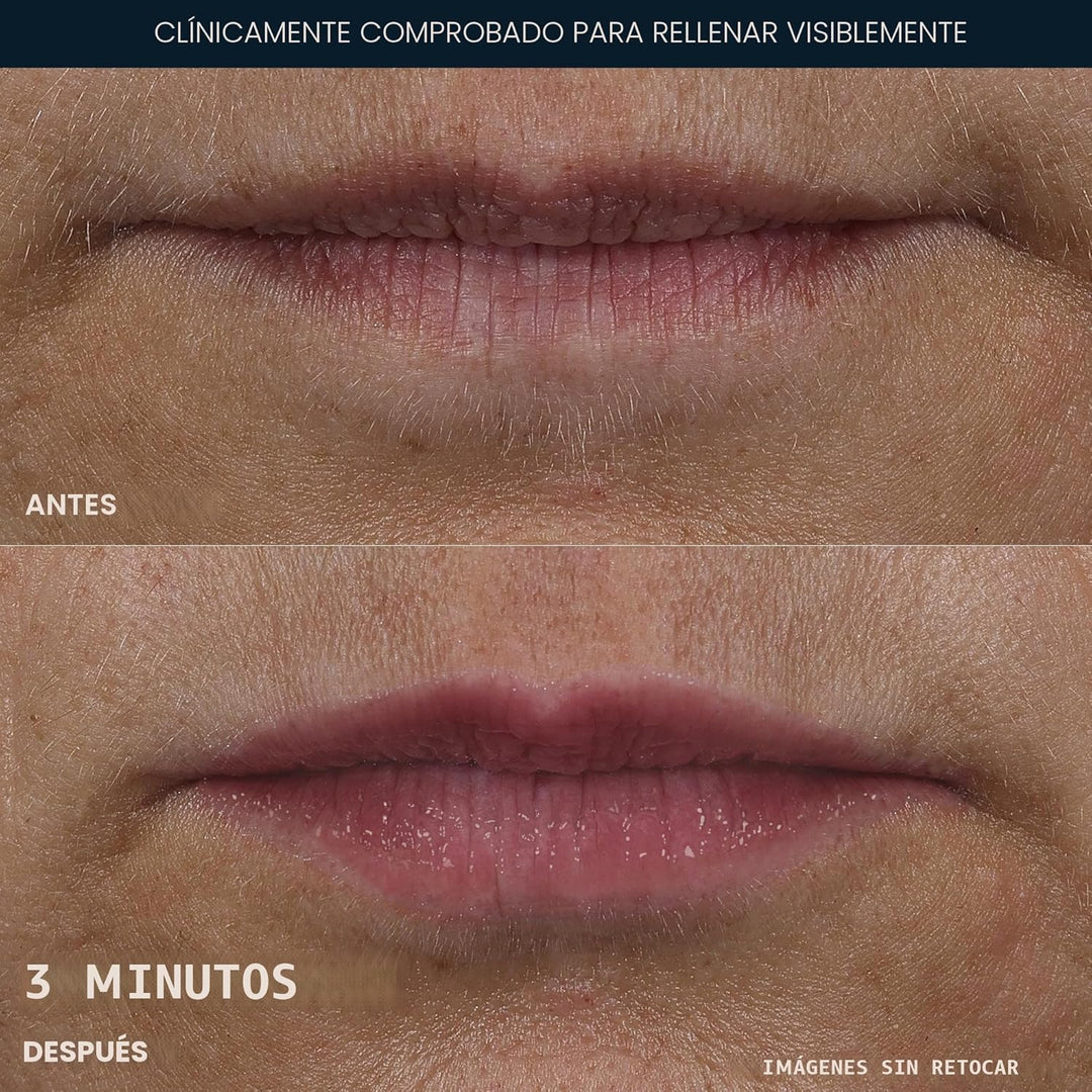 RoC Derm Correxion Lip Volumizer - Tratamiento de péptidos volumini...