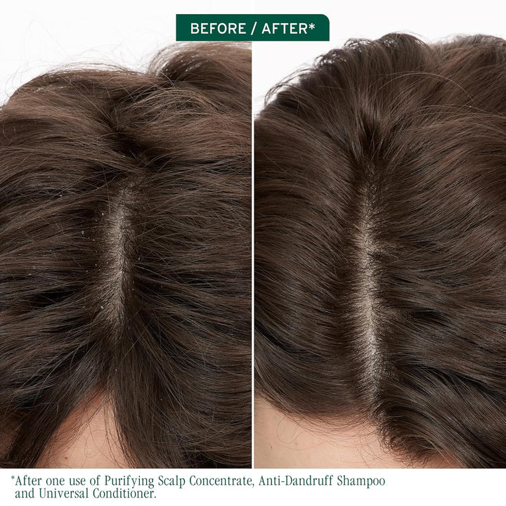 Biolage Scalp Sync Anti-Dandruff Shampoo - Controls Itchy Scalp, De...