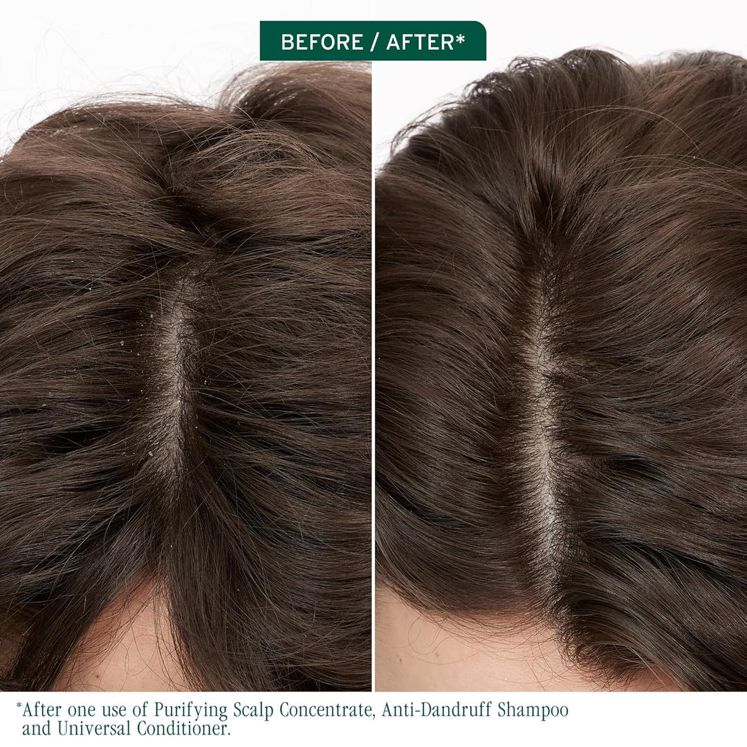 Biolage Scalp Sync Anti-Dandruff Shampoo - Controls Itchy Scalp, De...