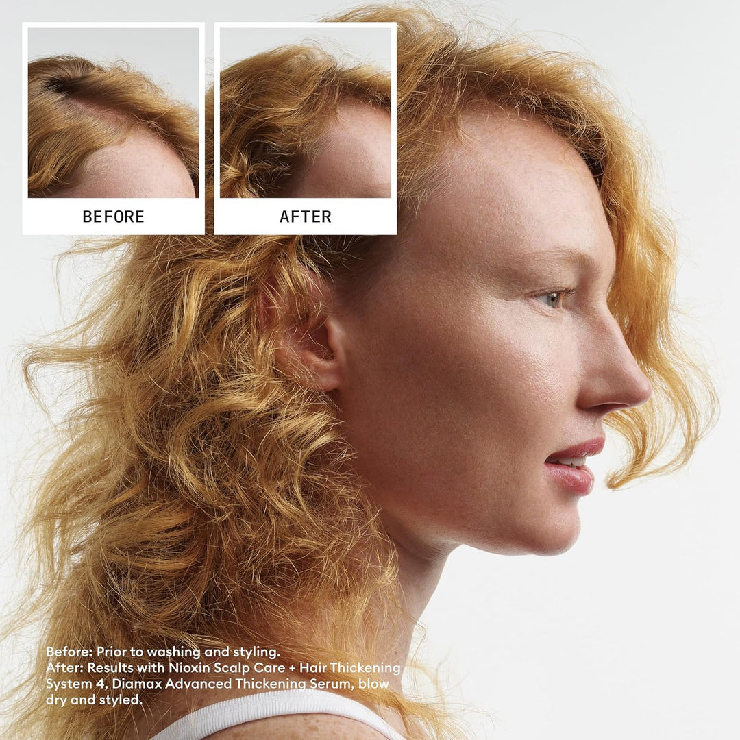 Nioxin System 4 Scalp Care + Hair Thickening Leave-In Treatment for...