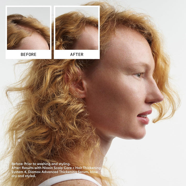 Nioxin System 4 Scalp Care + Hair Thickening Leave-In Treatment for...