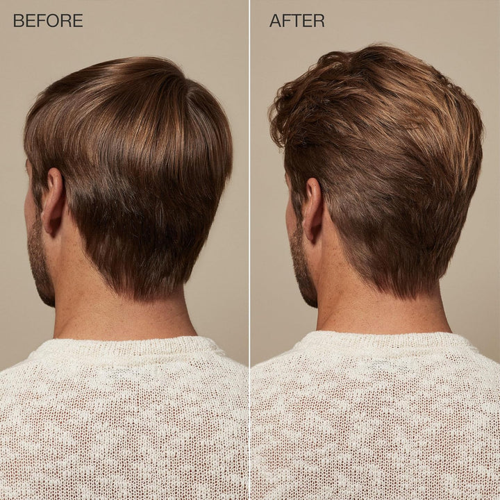 Tea Tree Scalp Care Regeniplex Tonic, tratamiento para el cuero cab...