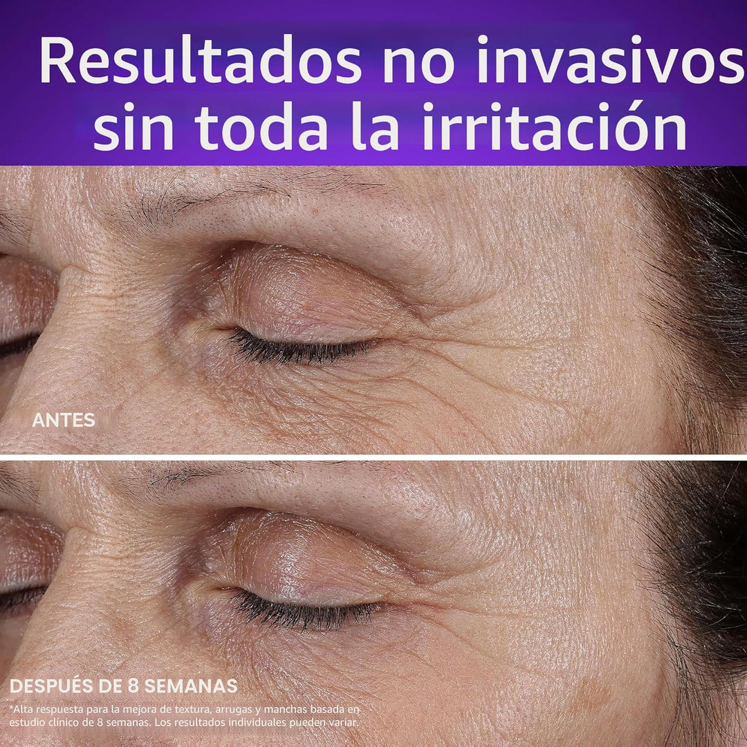 Olay Crema de noche de retinol para mujer, MAX, antienvejecimiento,...