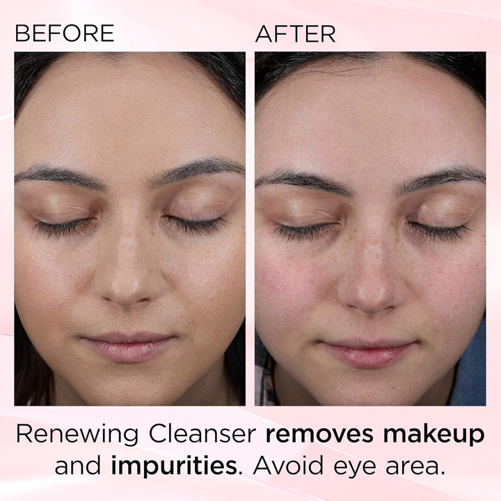 Elizabeth Arden Ceramide Skin Renewing Facial Cleanser, removedor d...