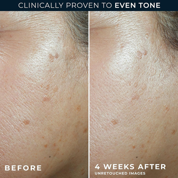RoC Multi Correxion 5 en 1 hidratante facial diario antienvejecimie...