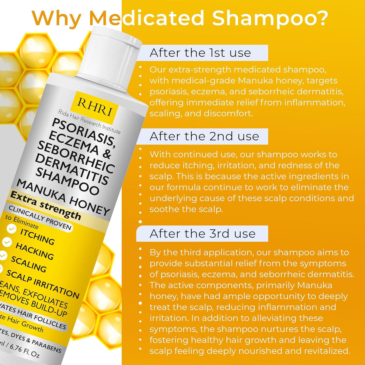 Champú antifúngico para psoriasis, eczema, champú para dermatitis s...