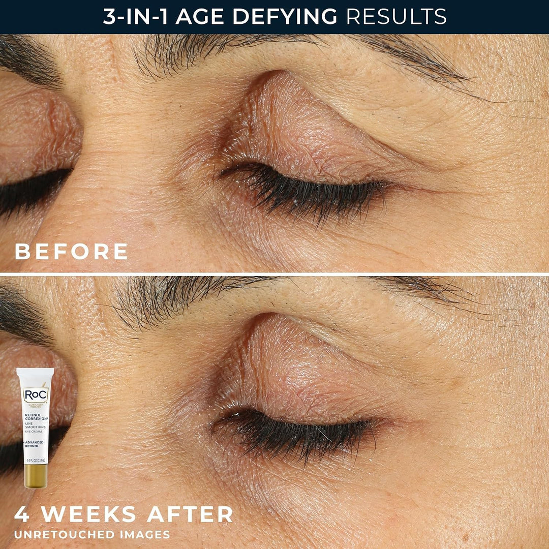 RoC Clinical Mini Retinol Kit de rutina para el cuidado de la piel...