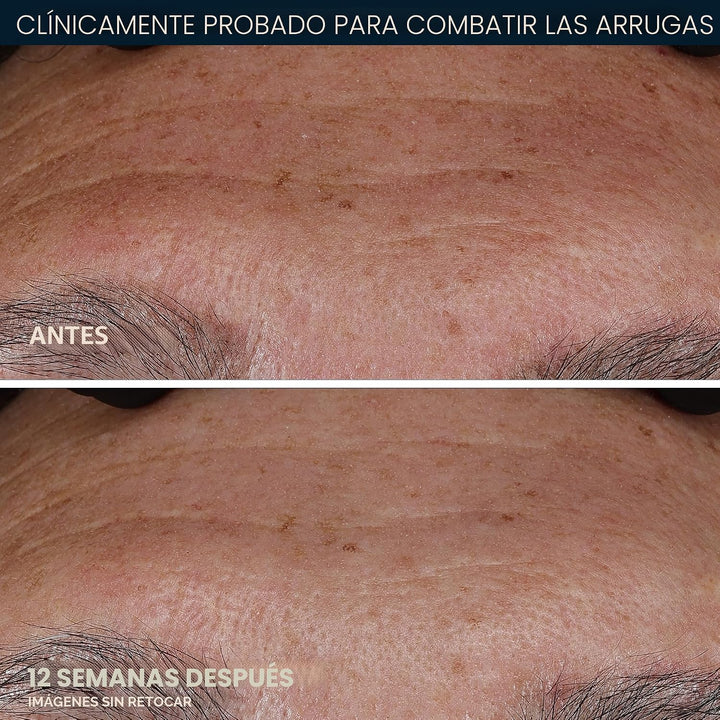 RoC Retinol Correxion Deep Wrinkle Retinol Face Serum con ácido asc...