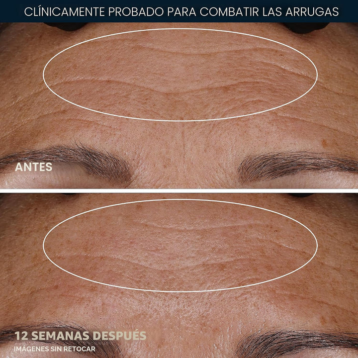 RoC Retinol Correxion Crema de noche para arrugas profundas, tratam...