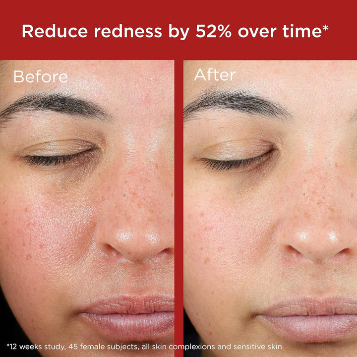 EltaMD Protector solar facial UV para recuperación de la piel con ó...