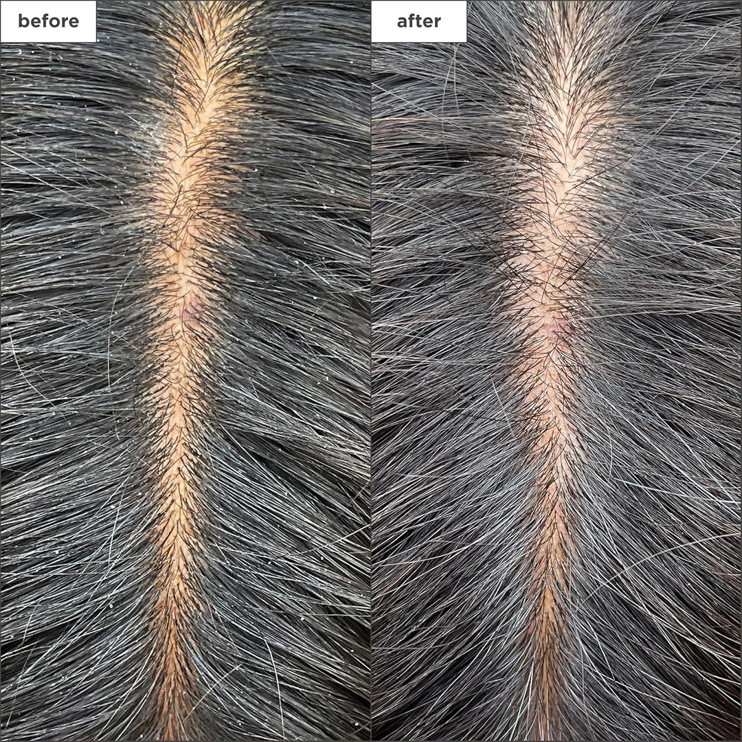 Briogeo Scalp Revival Charcoal + Tea Tree - Mascarilla refrescante...