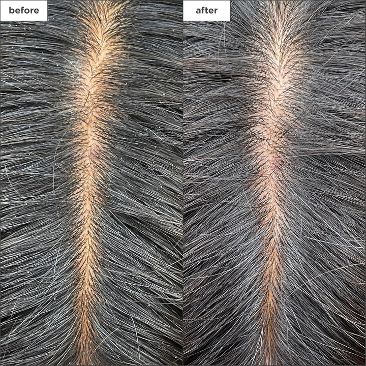 Briogeo Scalp Revival Charcoal + Tea Tree - Mascarilla refrescante...