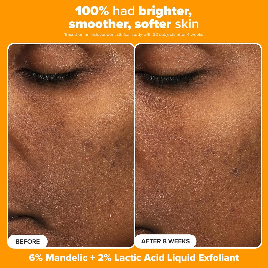 Paula's Choice BOOST C15 Super Booster, 15% Vitamin C Serum for...