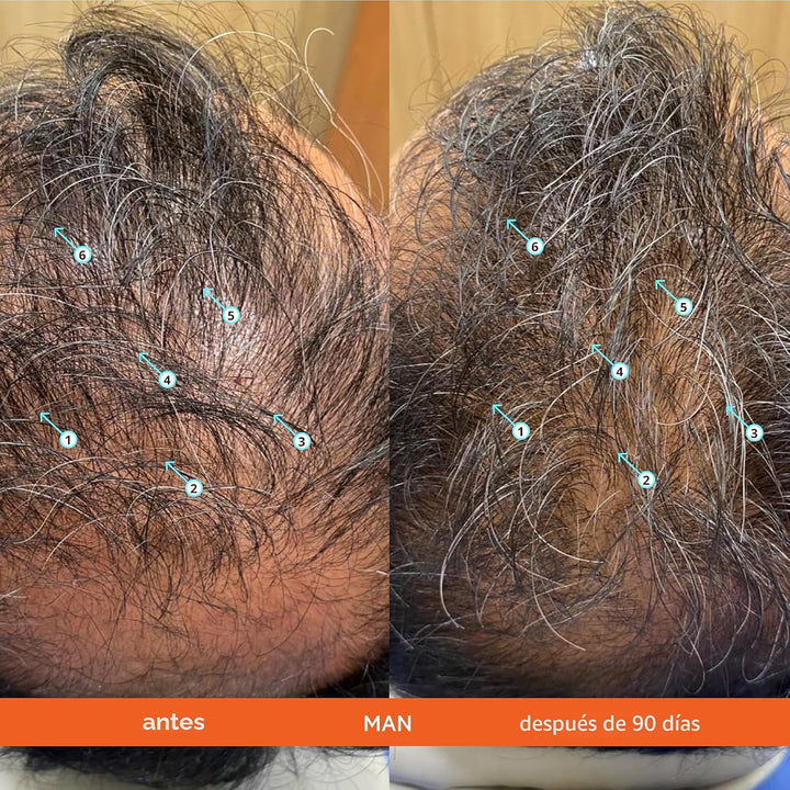 DS Labs Revita Hair Density Champú y acondicionador para cabello ad...
