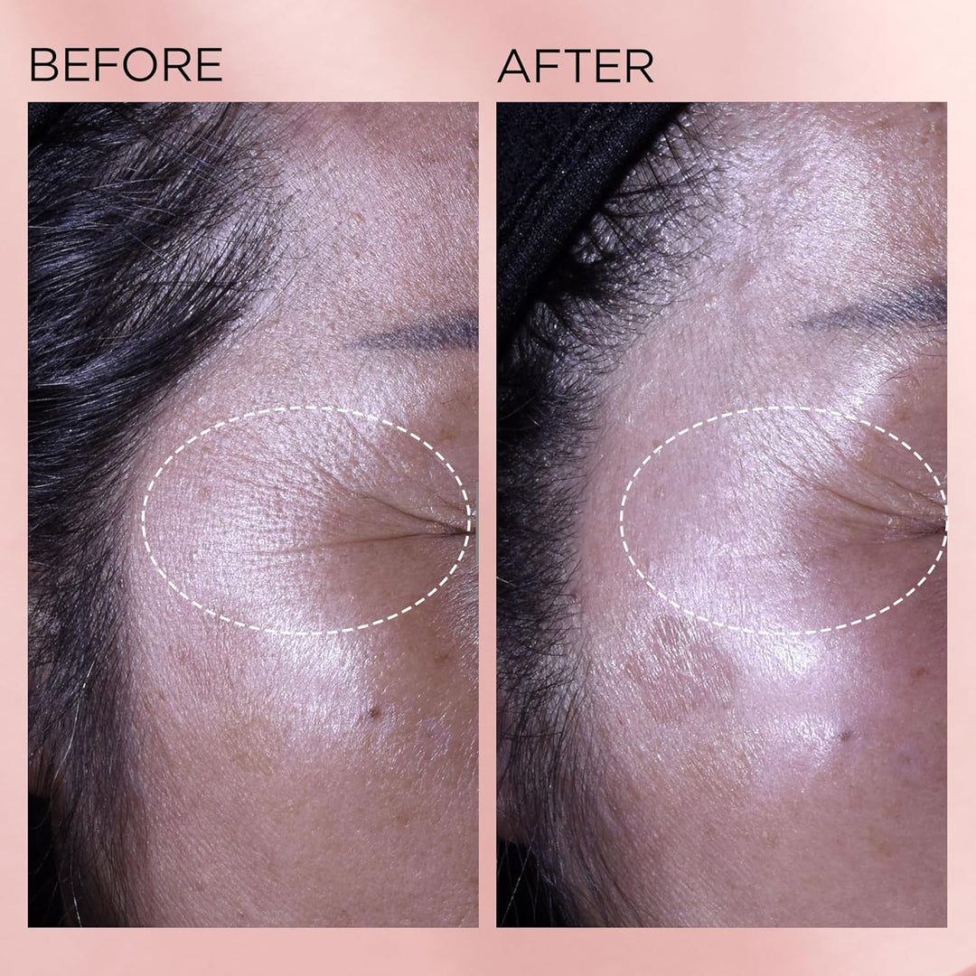 Cápsulas de suero facial de retinol + HPR de ceramidas de Elizabeth...