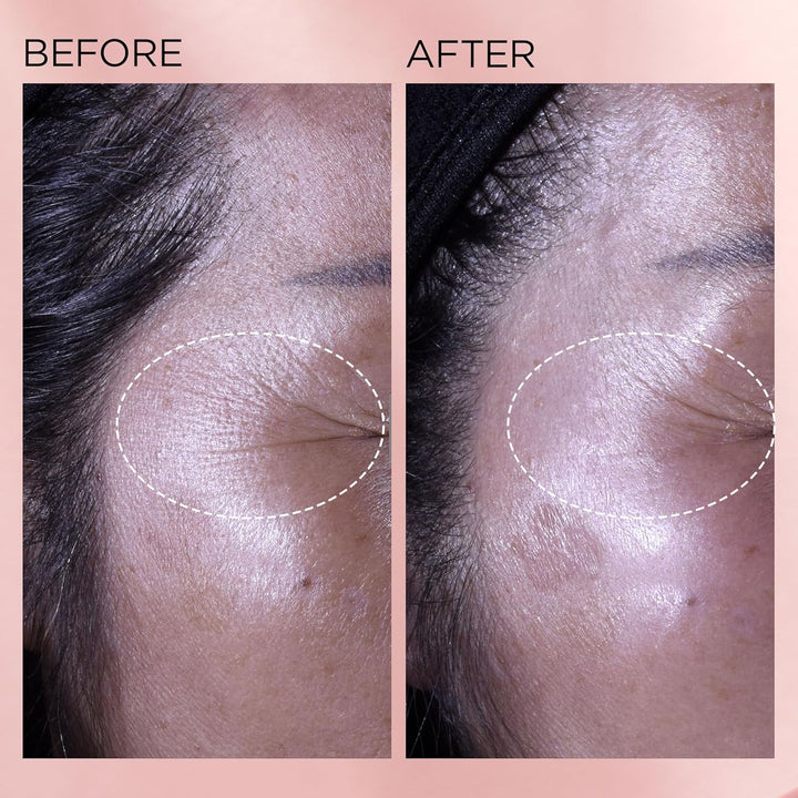 Cápsulas de suero facial de retinol + HPR de ceramidas de Elizabeth...