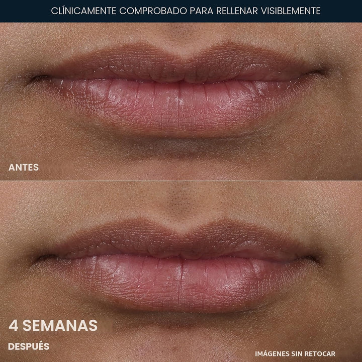 RoC Derm Correxion Lip Volumizer - Tratamiento de péptidos volumini...