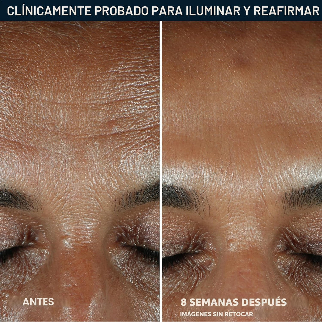 RoC Multi Correxion Revive + Glow - Suero facial con 10% de vitamin...