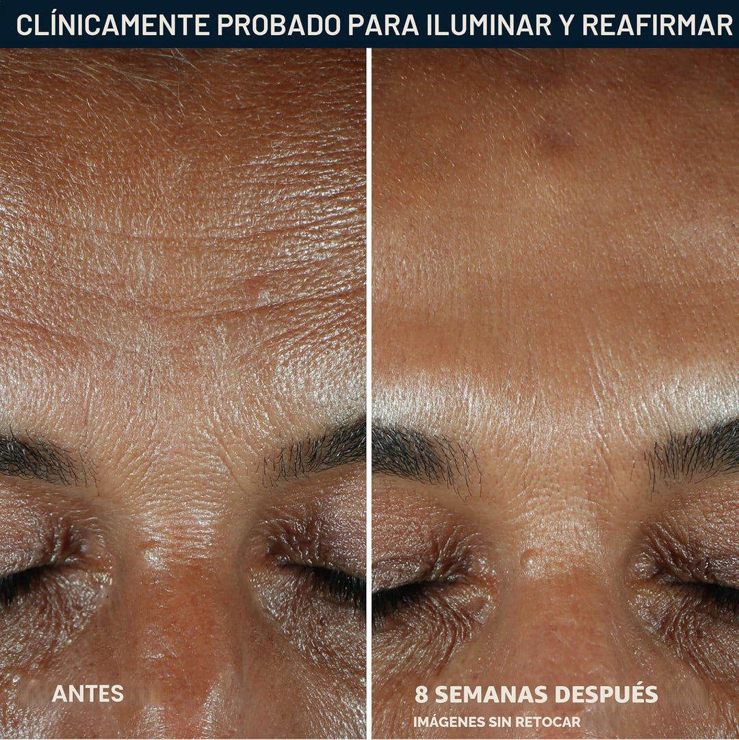 RoC Multi Correxion Revive + Glow - Suero facial con 10% de vitamin...