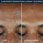 RoC Multi Correxion Revive + Glow - Suero facial con 10% de vitamin...