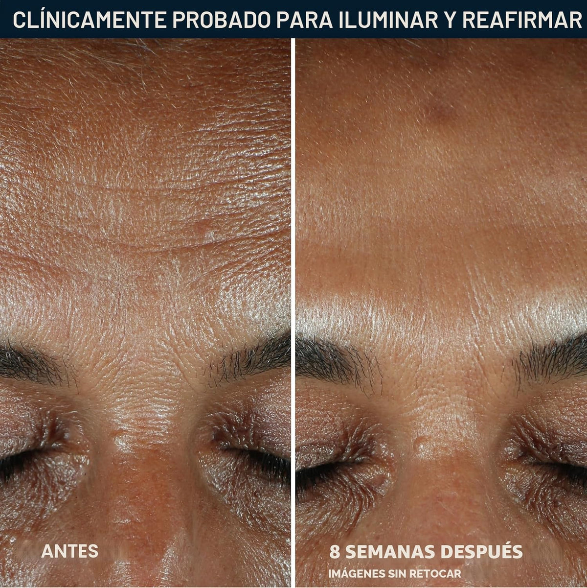 RoC Multi Correxion Revive + Glow - Suero facial con 10% de vitamin...