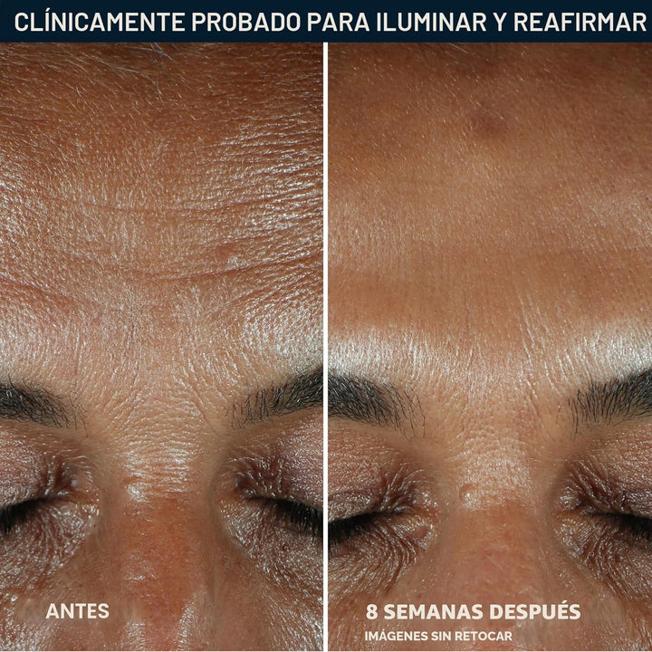 RoC Multi Correxion Revive + Glow - Suero facial con 10% de vitamin...