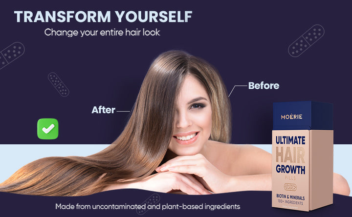 Moerie Suplemento Ultimate Hair Boost para mujeres y